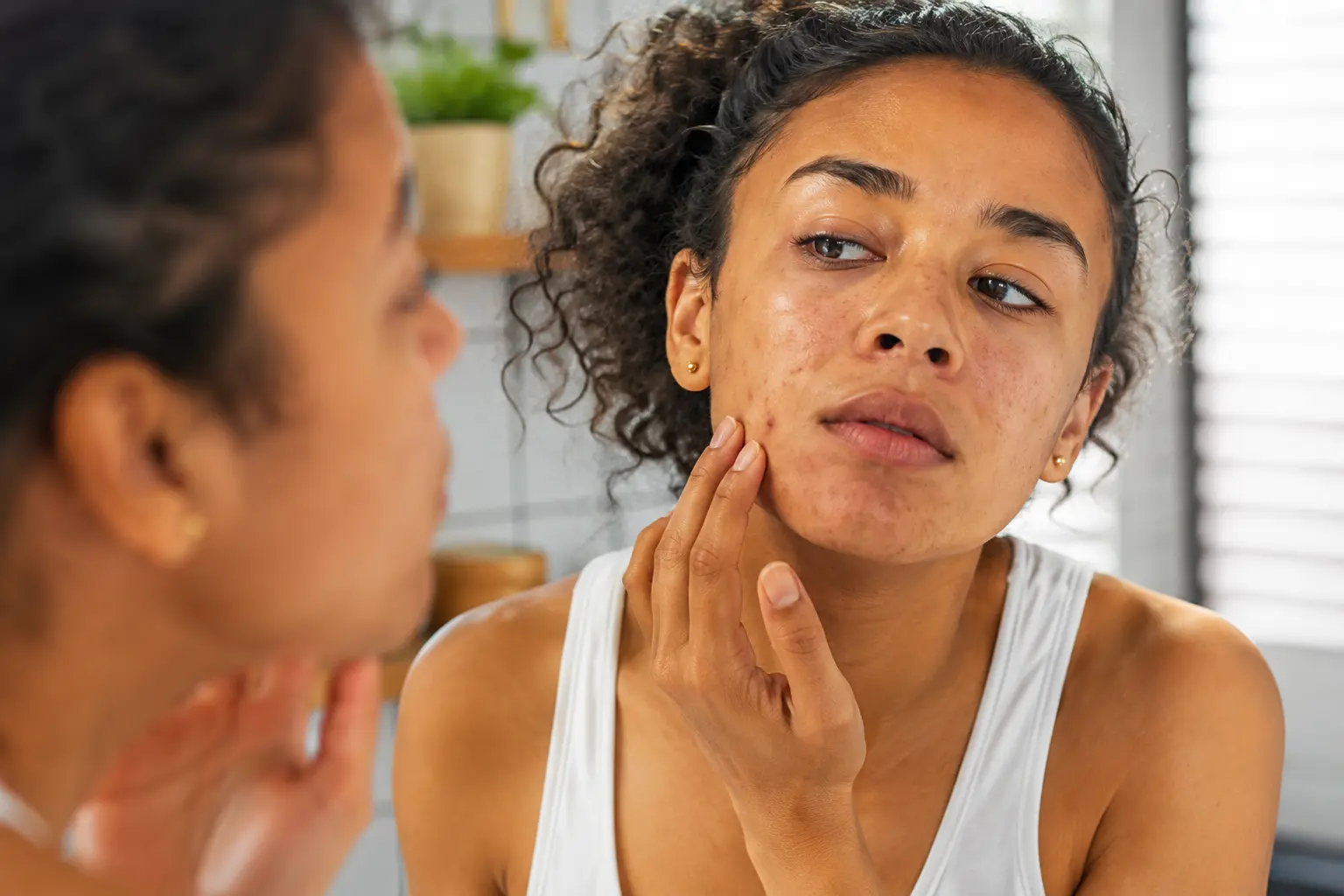 skin microbiome health explained tips and advice for women 